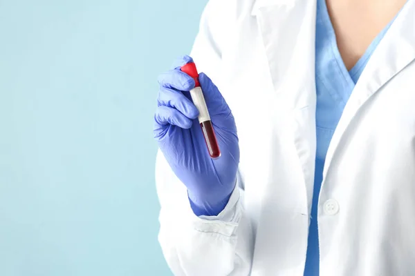 Médico Segurando Tubo Teste Com Amostra Sangue Fundo Cor Close — Fotografia de Stock