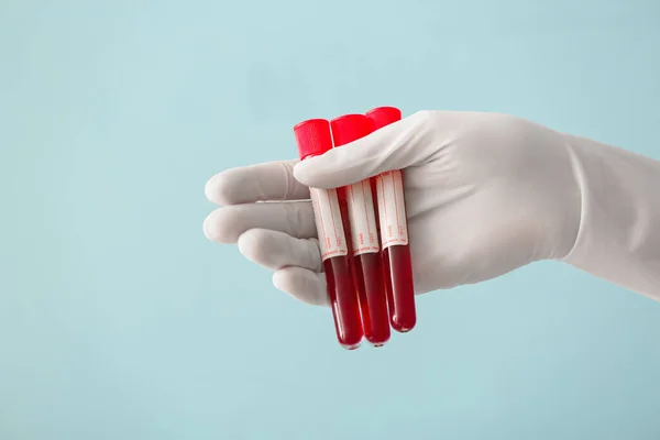 Doktorun Eli Renk Arkaplanında Kan Örnekleri Olan Test Tüplerini Tutuyor — Stok fotoğraf