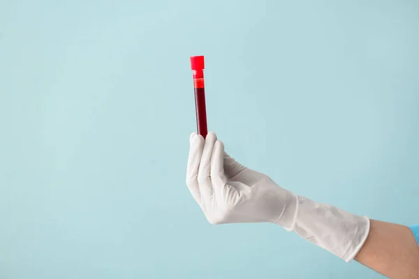 Mão Médico Segurando Tubo Teste Com Amostra Sangue Fundo Cor — Fotografia de Stock