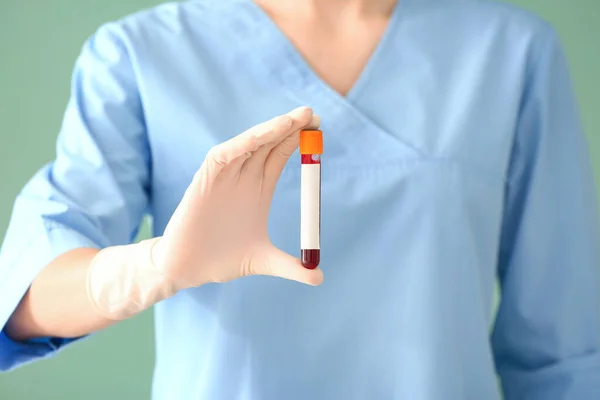 Doctor Holding Test Tube Blood Sample Color Background Closeup — Stock Photo, Image