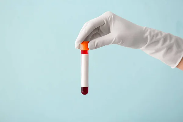 Doktorun Eli Renk Arkaplanında Kan Örneği Olan Test Tüpünü Tutuyor — Stok fotoğraf