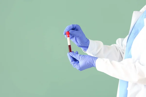 Doctor Holding Test Tube Blood Sample Color Background — Stock Photo, Image