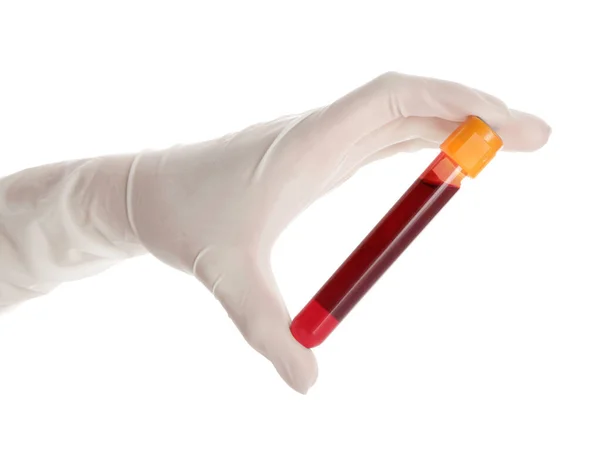 白地に血液サンプルと医師の手保持試験管 — ストック写真