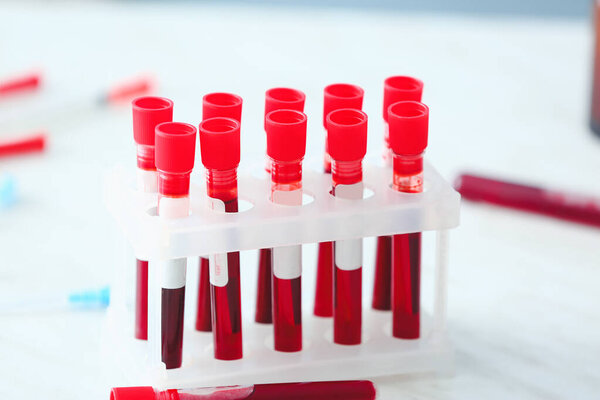 Test tubes with blood samples on table in laboratory, closeup