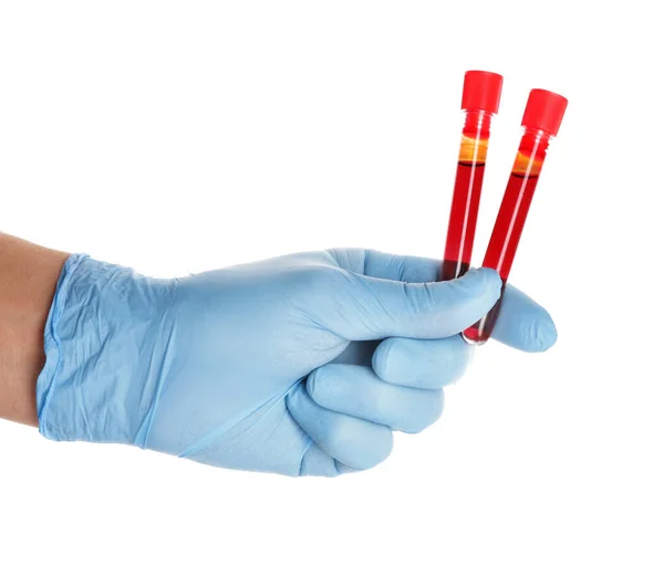 Doctor Hand Holding Test Tubes Blood Samples White Background — Stock Photo, Image