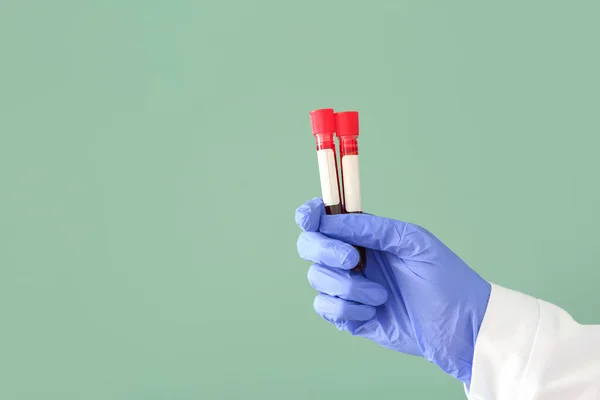 Doktorun Eli Renk Arkaplanında Kan Örnekleri Olan Test Tüplerini Tutuyor — Stok fotoğraf