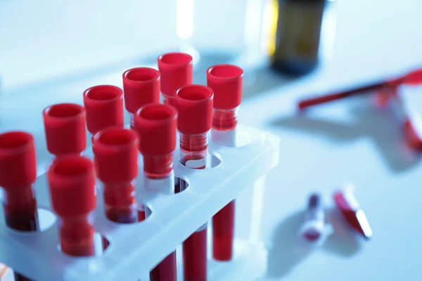 Tubos Ensayo Con Muestras Sangre Sobre Mesa Laboratorio Primer Plano — Foto de Stock