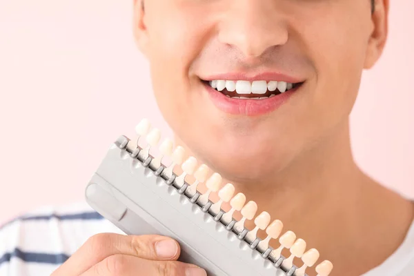 歯の色のサンプルを持つ男色の背景に クローズアップ — ストック写真