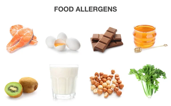 Set Diferentes Alimentos Alérgicos Sobre Fondo Blanco — Foto de Stock