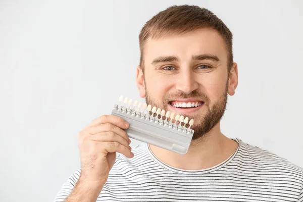 Young Man Teeth Color Samples Light Background — Stock Photo, Image