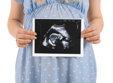 Beyaz arka planda sonogram görüntüsü olan güzel hamile kadın.