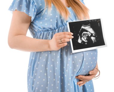 Beyaz arka planda sonogram görüntüsü olan güzel hamile kadın.