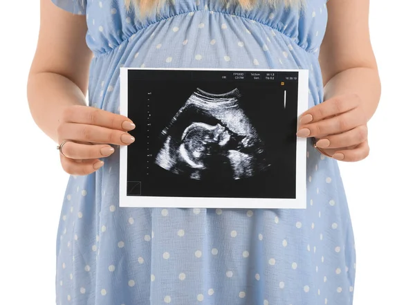 Красивая Беременная Женщина Изображением Узи Белом Фоне — стоковое фото