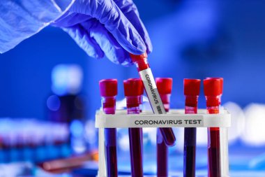 Laboratuvarda kan örnekleriyle çalışan bir kadın. Koronavirüs salgını kavramı