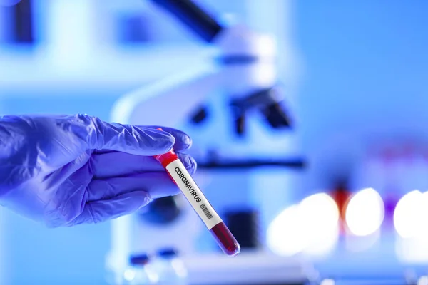 Woman Working Blood Sample Laboratory Concept Coronavirus Epidemic — Stock Photo, Image