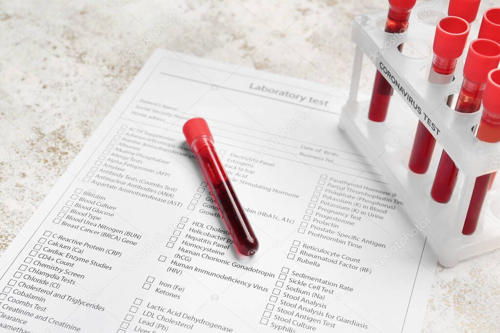 Laboratory test form and blood samples on table. Concept of coronavirus epidemic