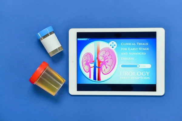 Tablettdator Och Urinprov Färg Bakgrund — Stockfoto