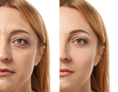 Beyaz arka planda estetik ameliyat öncesi ve sonrası kadın