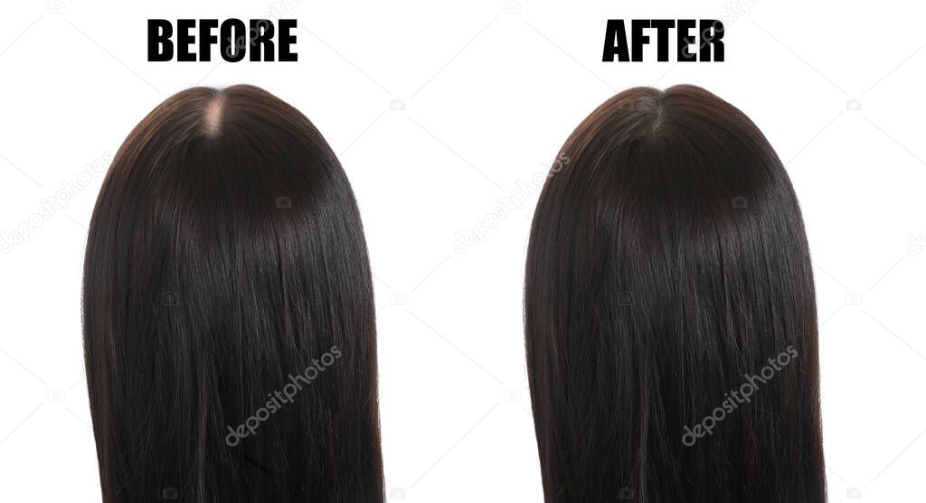 Woman before and after hair loss treatment on color background