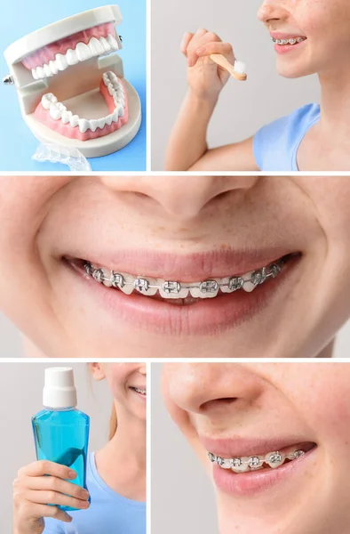 Nastolatka Aparatem Dentystycznym Sztuczną Szczęką — Zdjęcie stockowe