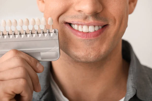 Mann Mit Zähnen Farbmuster Auf Hellem Hintergrund Nahaufnahme — Stockfoto