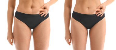 Beyaz arka planda anti-selülit tedavisi öncesi ve sonrası genç kadın