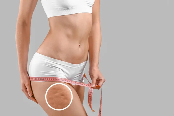 Young Woman Cellulite Problem Using Measuring Tape Light Background — Stock Photo, Image