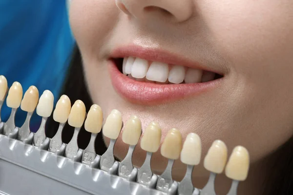 Dentist Checking Selecting Color Young Woman Teeth — Stock Photo, Image