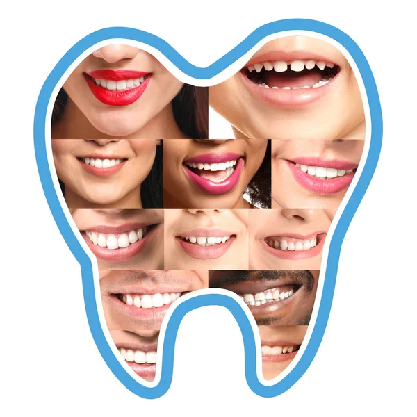 Beyaz Arka Planda Farklı Gülümseyen Insanlar Olan Diş Şekli — Stok fotoğraf