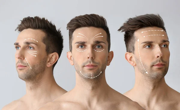 Collage Eines Gutaussehenden Jungen Mannes Auf Grauem Hintergrund Plastische Chirurgie — Stockfoto
