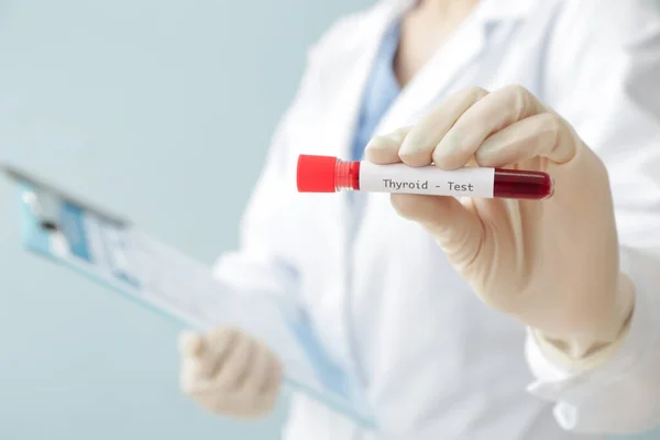 Test Tüpünde Kan Örneği Olan Doktor Yakın Plan Tiroit Hastalığı — Stok fotoğraf
