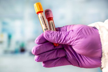 Hemşire 2019 nCoV analizi için kan testi tüpü tutuyor. Coronavirus kan testi konsepti.
