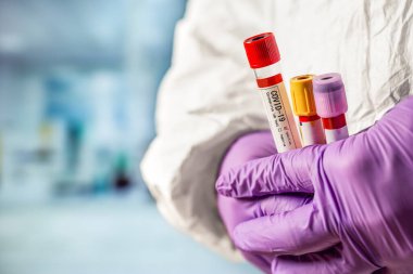 Hemşire 2019 nCoV analizi için kan testi tüpü tutuyor. Coronavirus kan testi konsepti.