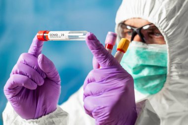 Solunum maskesi takan bilim adamları, hızla yayılan Coronavirus 'un kan testinin sonucunu tutuyor..