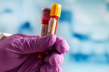 Hemşire 2019 nCoV analizi için kan testi tüpü tutuyor. Coronavirus kan testi konsepti.