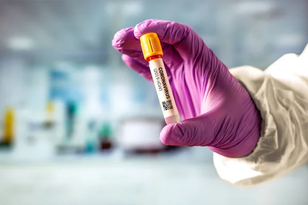 Mână Deține Tub Testare Pentru Analiza Coronavirus 2019 Ncov — Fotografie, imagine de stoc