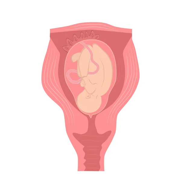 Baby in uterus during pregnancy - anatomical. Vector illustration. — 스톡 벡터