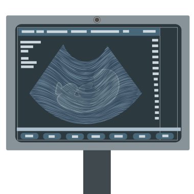 Ultrason cihazındaki çocuk..