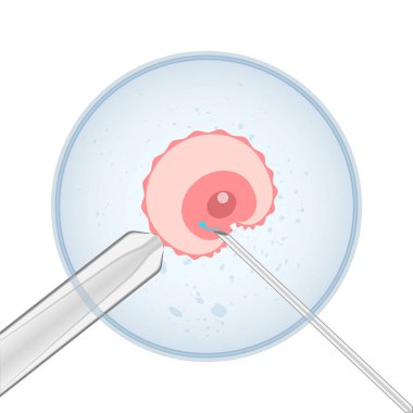 Ovum ve sperm mikroskop altında bir iğne üzerinde. Suni döllenme, illüstrasyon