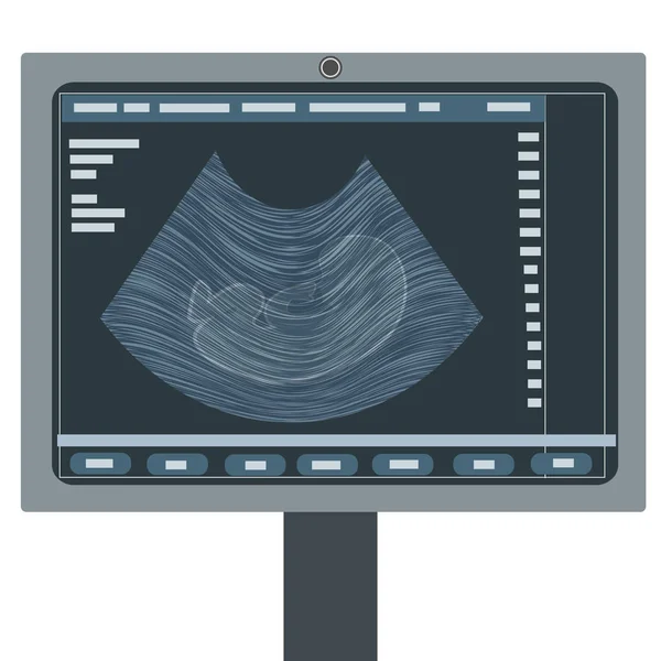 The kid on the monitor of the ultrasound machine. — Stock Vector