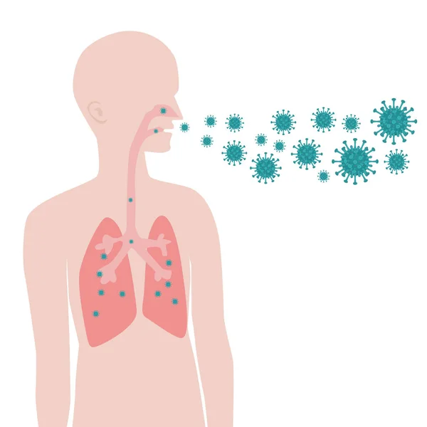 Formas de infección con virus. Transmisión aérea del virus . — Archivo Imágenes Vectoriales