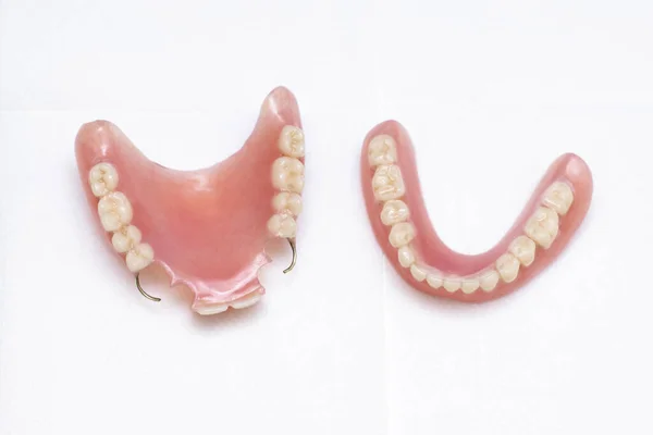 Dentures Leżą Białym Tle Górna Dolna Szczęka Widok Góry Protezy — Zdjęcie stockowe