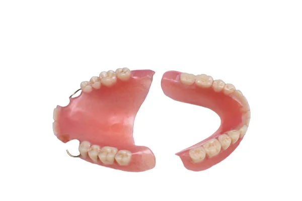 Les Prothèses Dentaires Reposent Sur Fond Blanc Mâchoire Supérieure Inférieure — Photo