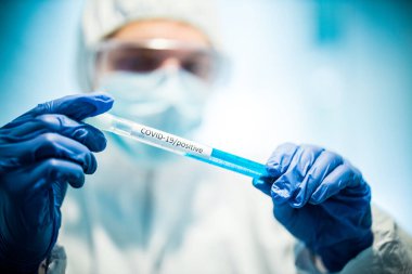 Corona virüsü konsepti. Erkek doktor test tüpünü tanıtıyor.