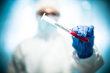 Corona virüsü konsepti. Erkek doktor test tüpünü tanıtıyor.