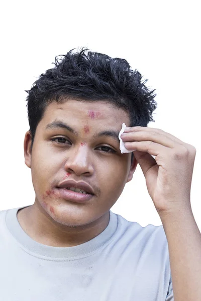 Man met kras schade op zijn gezicht — Stockfoto