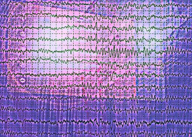 Brain wave on electroencephalogram EEG for epilepsy clipart