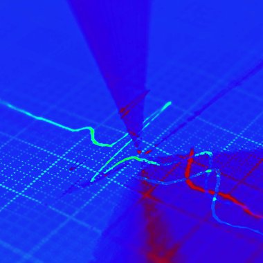 EKG grafiği, Elektrokardiyogram arka plan