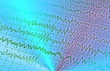 electroencephalogram, epilepsi, illüstrasyon için Eeg beyin dalga