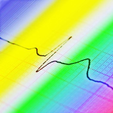 EKG grafiği, Elektrokardiyogram arka plan